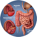 procedure picture