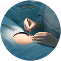 procedure picture