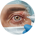 procedure picture