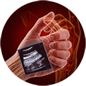 procedure picture