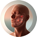procedure picture