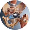 procedure picture