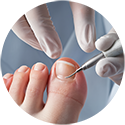 procedure picture
