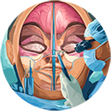 procedure picture
