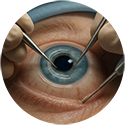 procedure picture