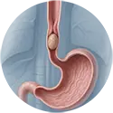 קשיי בליעה בהקשר גסטרואנטרולוגי