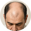 procedure picture