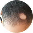 procedure picture