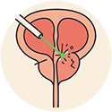 procedure picture