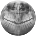procedure picture